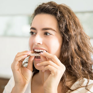 invisalign for teens